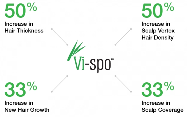 Vispo Chart GFX_Vi-spo chart